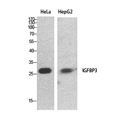 IGFBP3 Rabbit Polyclonal Antibody | 兔多抗 | EnkiLife恩玑生命
