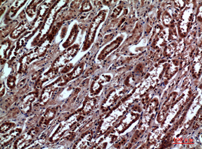 IGFBP3 Rabbit Polyclonal Antibody | 兔多抗 | EnkiLife恩玑生命