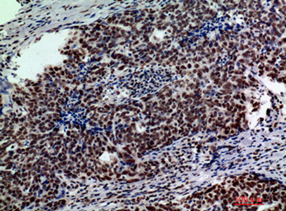 GLB1 Rabbit Polyclonal Antibody | 兔多抗 | EnkiLife恩玑生命