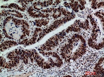 GLB1 Rabbit Polyclonal Antibody | 兔多抗 | EnkiLife恩玑生命