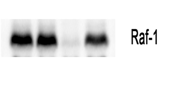Raf1 Rabbit Polyclonal Antibody | 兔多抗 | EnkiLife恩玑生命