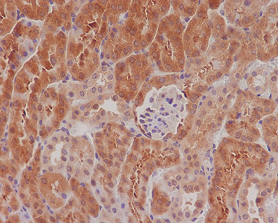 Phospho-eIF4E (Ser209) Rabbit Polyclonal Antibody | 兔多抗 | EnkiLife恩玑生命