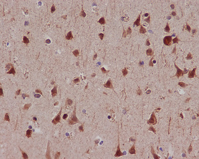 Phospho-MSK1 (Ser376) Rabbit Polyclonal Antibody | 兔多抗 | EnkiLife恩玑生命
