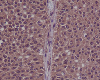 Phospho-CDK2 (Tyr15) Rabbit Polyclonal Antibody | 兔多抗 | EnkiLife恩玑生命