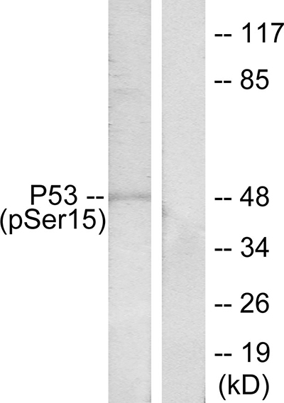 Phospho-p53 (Ser15) Rabbit Polyclonal Antibody | 兔多抗 | EnkiLife恩玑生命