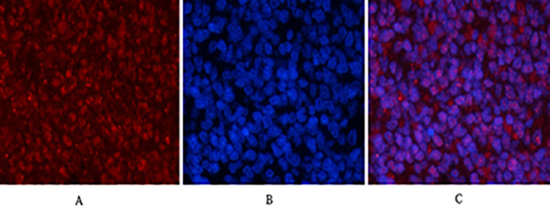 Phospho-p53 (Ser15) Rabbit Polyclonal Antibody | 兔多抗 | EnkiLife恩玑生命