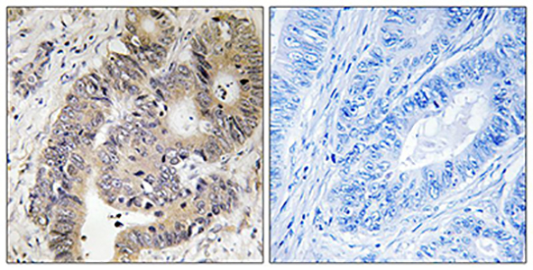 Phospho-CAD (Thr456) Rabbit Polyclonal Antibody | 兔多抗 | EnkiLife恩玑生命