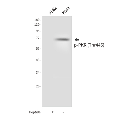 Phospho-PKR (Thr446) Rabbit Polyclonal Antibody | 兔多抗 | EnkiLife恩玑生命