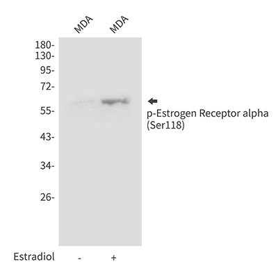 Phospho-Estrogen Receptor alpha (Ser118) Rabbit Polyclonal Antibody | 兔多抗 | EnkiLife恩玑生命
