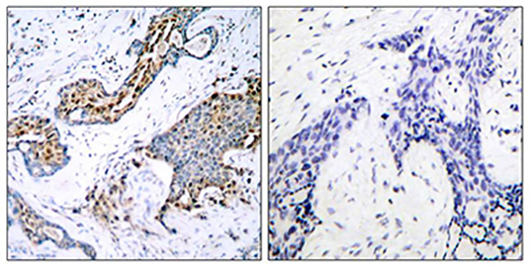 Phospho-Estrogen Receptor alpha (Ser118) Rabbit Polyclonal Antibody | 兔多抗 | EnkiLife恩玑生命