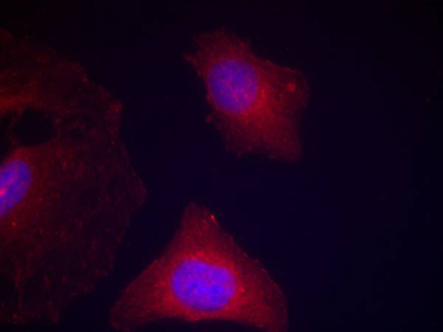 Phospho-GSK3 (Tyr279/Tyr216) Rabbit Polyclonal Antibody | 兔多抗 | EnkiLife恩玑生命