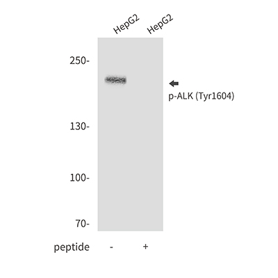 Phospho-ALK (Tyr1604) Rabbit Polyclonal Antibody | 兔多抗 | EnkiLife恩玑生命