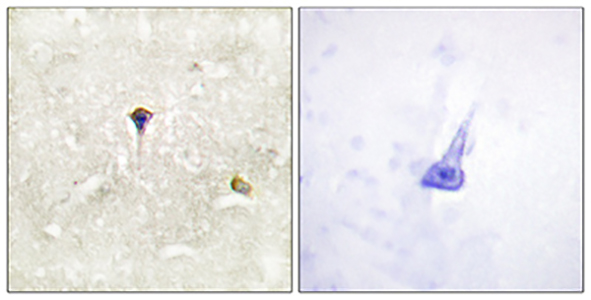 Phospho-ALK (Tyr1604) Rabbit Polyclonal Antibody | 兔多抗 | EnkiLife恩玑生命