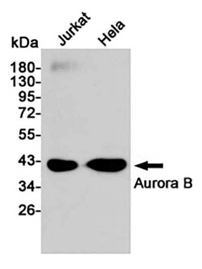 Aurora B Rabbit Polyclonal Antibody | 兔多抗 | EnkiLife恩玑生命