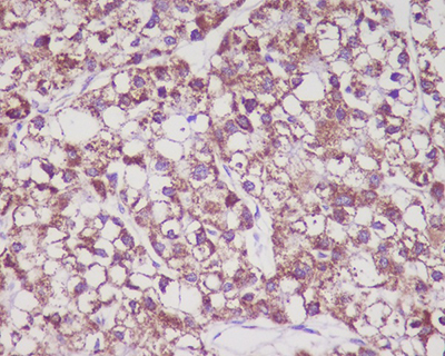 MMP3 Rabbit Polyclonal Antibody | 兔多抗 | EnkiLife恩玑生命