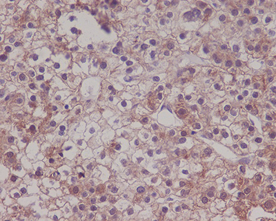 LRP1 Rabbit Polyclonal Antibody | 兔多抗 | EnkiLife恩玑生命