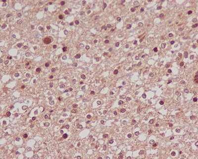 FOXO1 Rabbit Polyclonal Antibody | 兔多抗 | EnkiLife恩玑生命