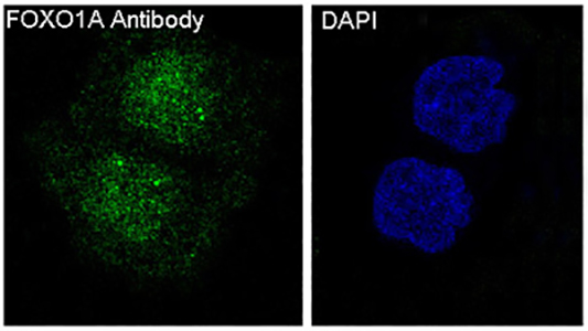 FOXO1 Rabbit Polyclonal Antibody | 兔多抗 | EnkiLife恩玑生命