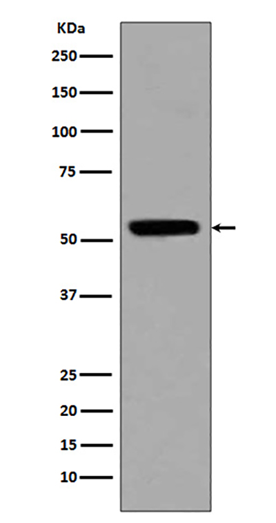 Acetyl-p53 (Lys370) Rabbit Polyclonal Antibody | 兔多抗 | EnkiLife恩玑生命