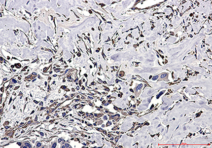 CAP1 Rabbit Polyclonal Antibody | 兔多抗 | EnkiLife恩玑生命