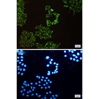 CAP1 Rabbit Polyclonal Antibody | 兔多抗 | EnkiLife恩玑生命