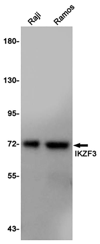 IKZF3 Rabbit Polyclonal Antibody | 兔多抗 | EnkiLife恩玑生命