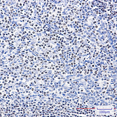 IKZF3 Rabbit Polyclonal Antibody | 兔多抗 | EnkiLife恩玑生命