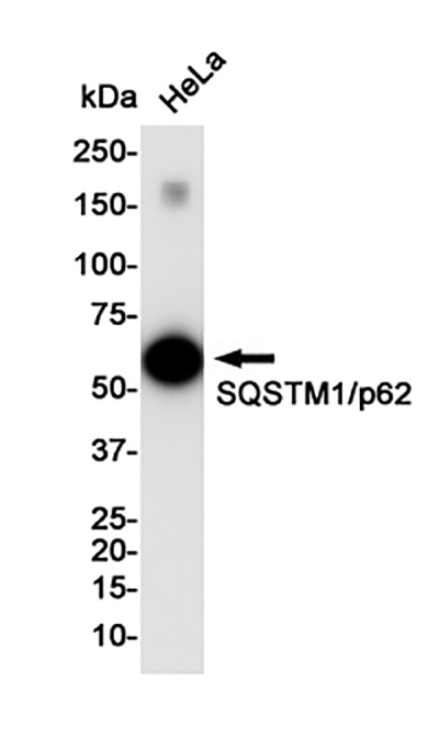 SQSTM1/p62 Rabbit Polyclonal Antibody | 兔多抗 | EnkiLife恩玑生命