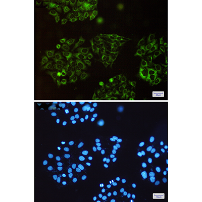 SQSTM1/p62 Rabbit Polyclonal Antibody | 兔多抗 | EnkiLife恩玑生命