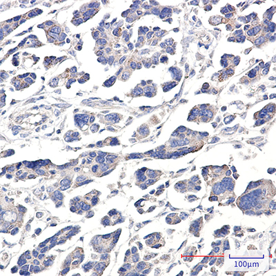 APG5L Rabbit Polyclonal Antibody | 兔多抗 | EnkiLife恩玑生命