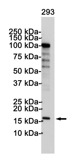 CDKN2A/p16INK4a Rabbit Polyclonal Antibody | 兔多抗 | EnkiLife恩玑生命