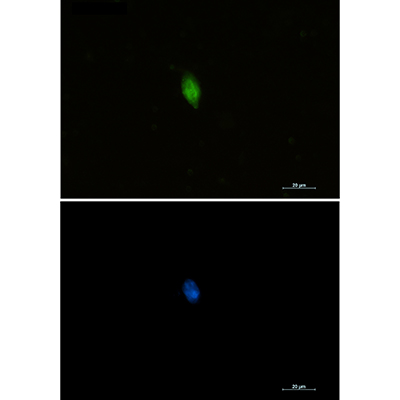 CDKN2A/p16INK4a Rabbit Polyclonal Antibody | 兔多抗 | EnkiLife恩玑生命