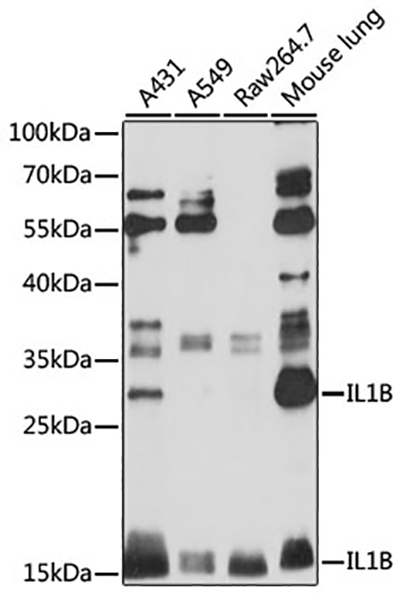 IL-1 beta Rabbit Polyclonal Antibody | 兔多抗 | EnkiLife恩玑生命