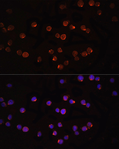 IL-1 beta Rabbit Polyclonal Antibody | 兔多抗 | EnkiLife恩玑生命