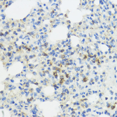 IL-1 beta Rabbit Polyclonal Antibody | 兔多抗 | EnkiLife恩玑生命