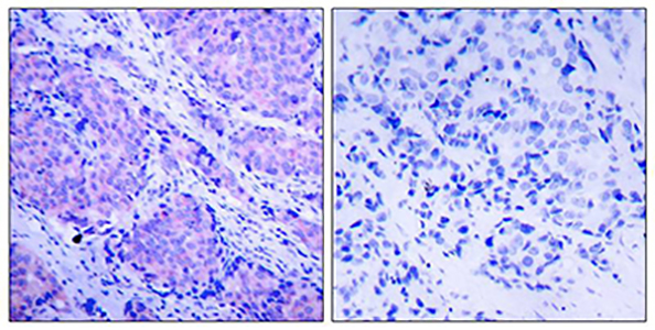 Phospho-PDPK1 (Ser241) Rabbit Polyclonal Antibody | 兔多抗 | EnkiLife恩玑生命