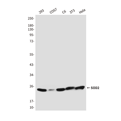 SOD2 Rabbit Polyclonal Antibody | 兔多抗 | EnkiLife恩玑生命