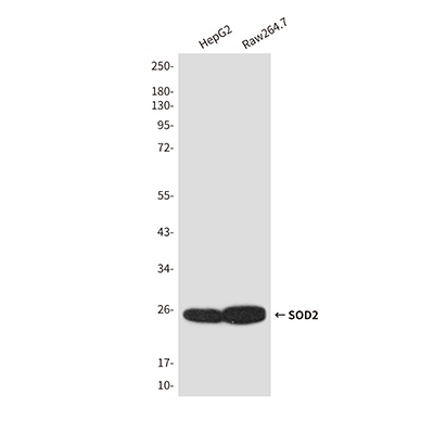 SOD2 Rabbit Polyclonal Antibody | 兔多抗 | EnkiLife恩玑生命