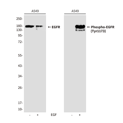 Phospho-EGFR (Tyr1173) Rabbit Polyclonal Antibody | 兔多抗 | EnkiLife恩玑生命