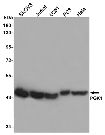 PGK1 Rabbit Polyclonal Antibody | 兔多抗 | EnkiLife恩玑生命