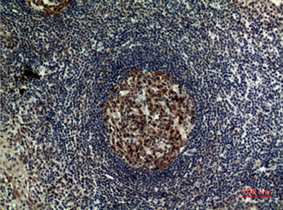 FOXP3 Rabbit Polyclonal Antibody | 兔多抗 | EnkiLife恩玑生命