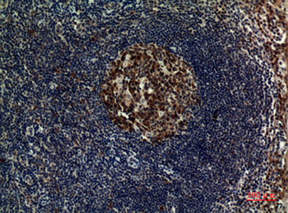 FOXP3 Rabbit Polyclonal Antibody | 兔多抗 | EnkiLife恩玑生命