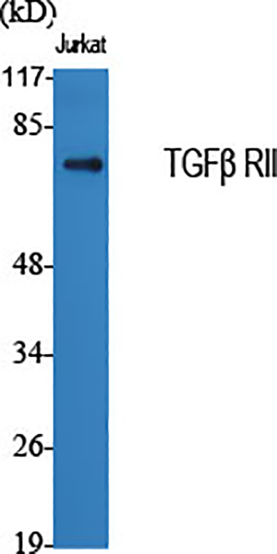 TGF beta Receptor II Rabbit Polyclonal Antibody | 兔多抗 | EnkiLife恩玑生命