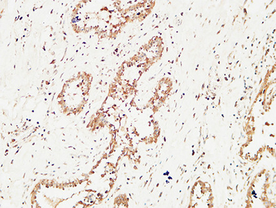 c-Kit Rabbit Polyclonal Antibody | 兔多抗 | EnkiLife恩玑生命