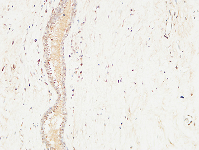 c-Kit Rabbit Polyclonal Antibody | 兔多抗 | EnkiLife恩玑生命