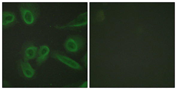 CD31 Rabbit Polyclonal Antibody | 兔多抗 | EnkiLife恩玑生命