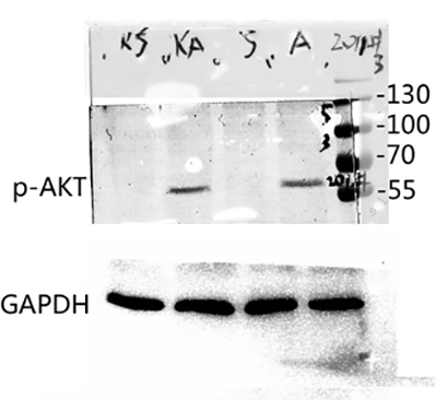 Akt1 (phospho Thr450) Rabbit Polyclonal Antibody | 兔多抗 | EnkiLife恩玑生命