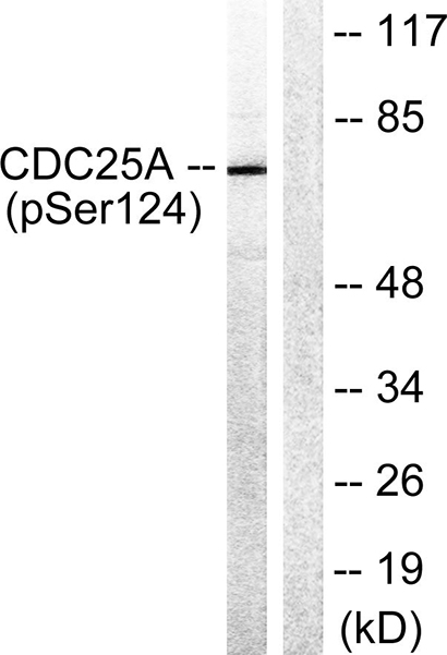 Cdc25A (phospho Ser124) Rabbit Polyclonal Antibody | 兔多抗 | EnkiLife恩玑生命