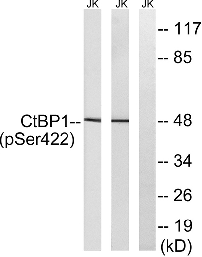 CtBP1 (phospho Ser422) Rabbit Polyclonal Antibody | 兔多抗 | EnkiLife恩玑生命