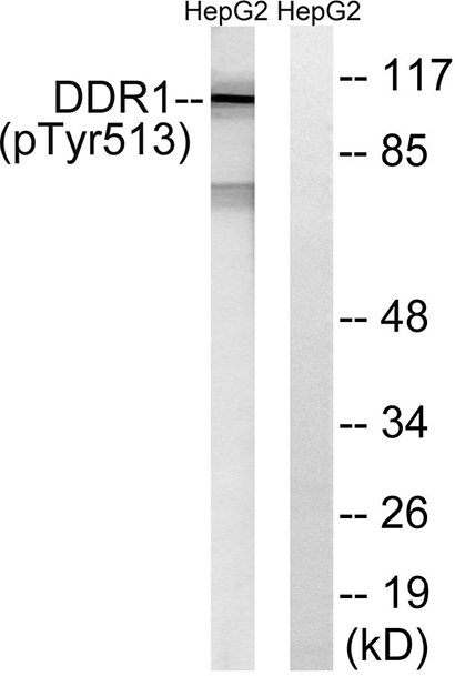 DDR1 (phospho Tyr513) Rabbit Polyclonal Antibody | 兔多抗 | EnkiLife恩玑生命